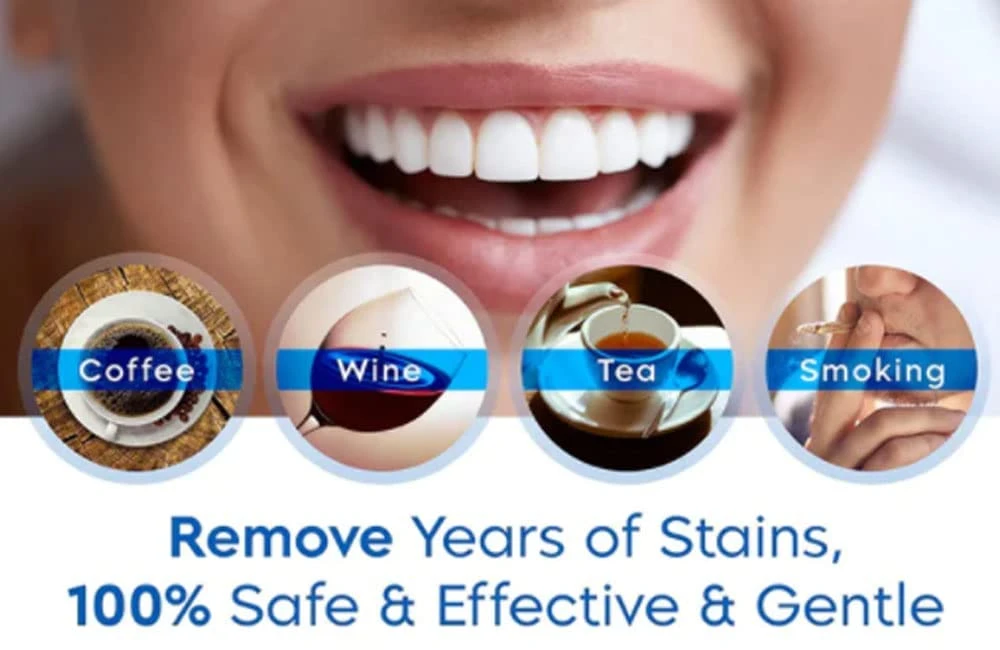 Herbaluxy Teeth Whitening Reviews – Is It Really The Best Teeth Whitening Product?