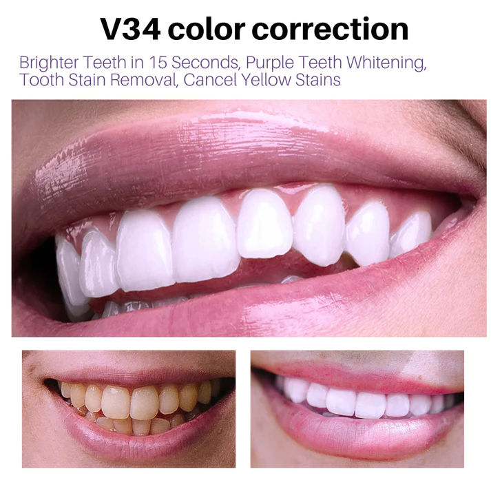 Smilekit V34 Review - Smilekit® V34 Colour Corrector Serum Worth It?